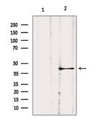 GNA11 Polyclonal Antibody