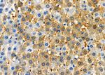 NAP1L1 Polyclonal Antibody