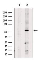 ENPP7 Antibody in Western Blot (WB)