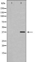 Follistatin Polyclonal Antibody