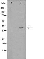 GRPR Polyclonal Antibody