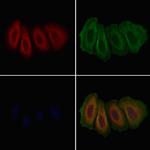 GLRA1 Polyclonal Antibody