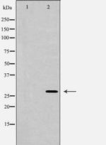 HOXC8 Antibody in Western Blot (WB)