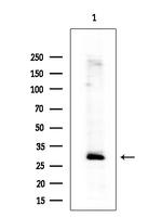 IGFBP7 Antibody in Western Blot (WB)
