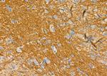 Kallikrein 5 Antibody in Immunohistochemistry (Paraffin) (IHC (P))