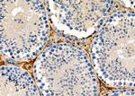 Luteinizing Hormone-beta Antibody in Immunohistochemistry (Paraffin) (IHC (P))