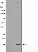 Luteinizing Hormone-beta Antibody in Western Blot (WB)