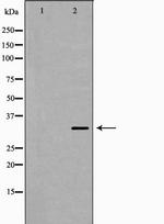 MC2R Polyclonal Antibody