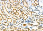PDK4 Antibody in Immunohistochemistry (Paraffin) (IHC (P))