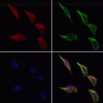 PIBF1 Polyclonal Antibody