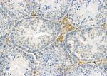 PIWIL2 Polyclonal Antibody