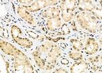 Gemin 2 Polyclonal Antibody