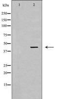Nkx2.1 Polyclonal Antibody