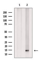 SUMO4 Antibody in Western Blot (WB)
