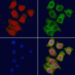 MYSM1 Polyclonal Antibody