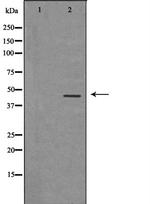 NPY1R Polyclonal Antibody
