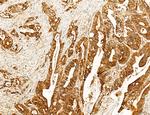 SLC22A8 Polyclonal Antibody