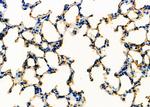 SFTPA1 Polyclonal Antibody