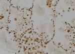 RAD23A Polyclonal Antibody