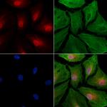 MNAR Polyclonal Antibody