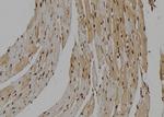 NLK Antibody in Immunohistochemistry (Paraffin) (IHC (P))