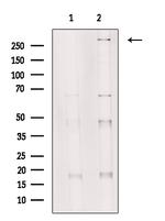 SETD2 Polyclonal Antibody