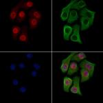 H3K14me2 Antibody in Immunocytochemistry (ICC/IF)