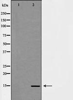 H3K14me3 Polyclonal Antibody