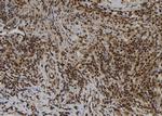 EMAP II Polyclonal Antibody