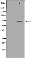 Plasma Kallikrein Polyclonal Antibody