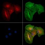 PDZK1 Polyclonal Antibody