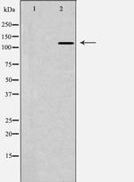POLD1 Polyclonal Antibody