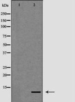 S100A12 Antibody in Western Blot (WB)