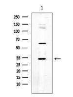 SGCE Polyclonal Antibody