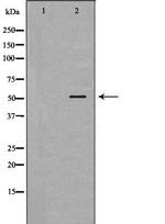 BPI Polyclonal Antibody