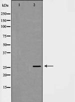 C1QB Polyclonal Antibody