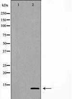 GHRH Polyclonal Antibody