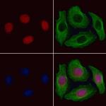 GTF2A1 Polyclonal Antibody
