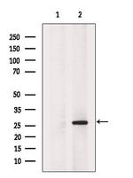 HDGF Polyclonal Antibody