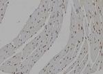 IMPDH2 Polyclonal Antibody