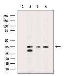 LUM Antibody in Western Blot (WB)