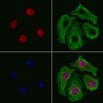 SMARCE1 Polyclonal Antibody