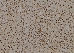 SMARCE1 Antibody in Immunohistochemistry (Paraffin) (IHC (P))