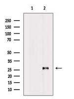 VAPB Polyclonal Antibody