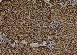 RAD18 Polyclonal Antibody