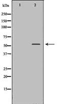 RAD18 Antibody in Western Blot (WB)