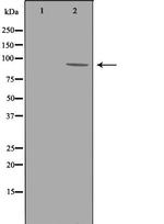 ADAM9 Polyclonal Antibody