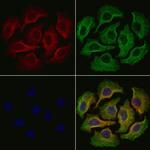 Properdin Polyclonal Antibody