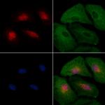 HEC1 Polyclonal Antibody