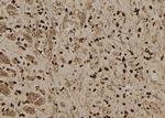 SERPINB3 Polyclonal Antibody